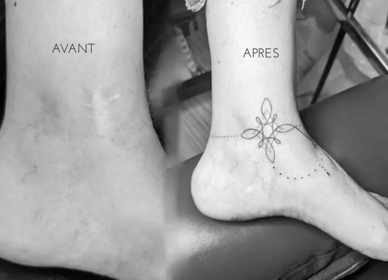 cover tattoo / recouvrement ou rafraichissement de tatouage ou cicatrice, Noaillan, Fragments d'Elle